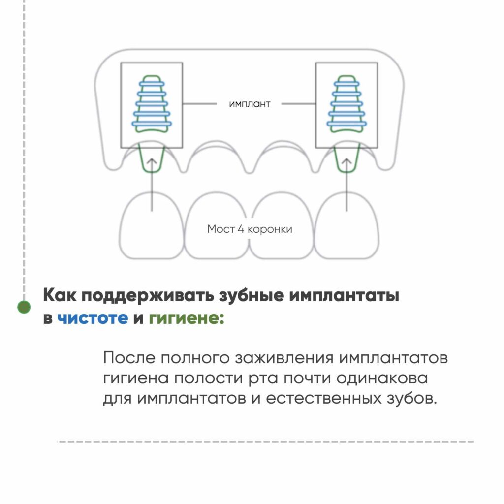 Руководство по уходу за имплантами 4 стр.