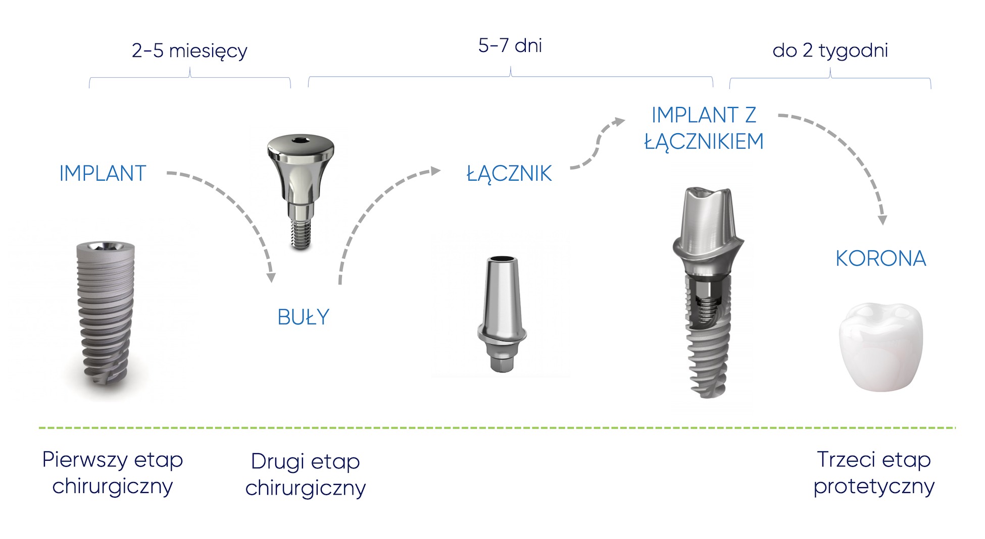 Z czego więc składa się implant dentystyczny i jaki jest całkowity koszt implantu