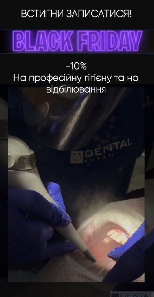 Відбілювання зубів та Професійна гігієна Львів акції знижка