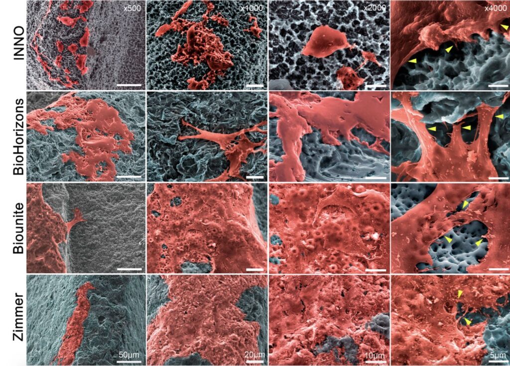 Вплив поверхні дентальних імплантатів на адгезию