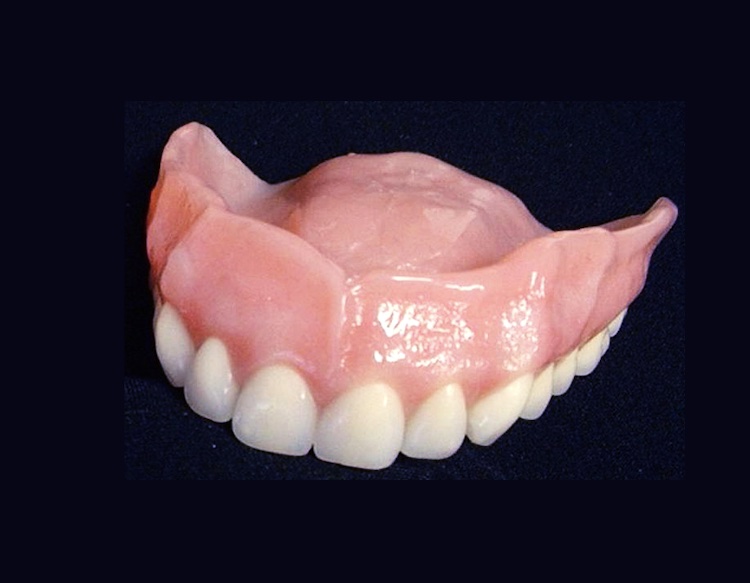 Сколько стоит вставить зуб: съемные протезы