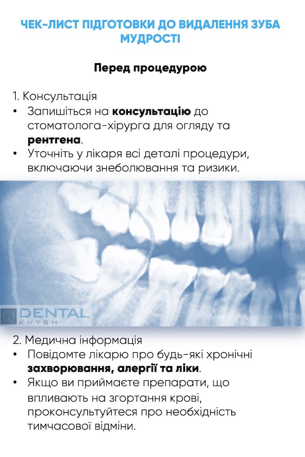 чек-лист підготовка до видалення зуба мудрості 1