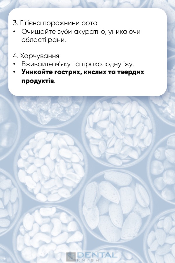 чек-лист підготовка до видалення зуба мудрості 7