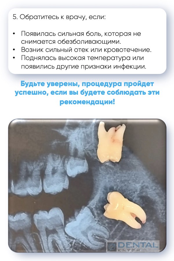 Чек-лист Подготовка к удалению зуба мудрости 7