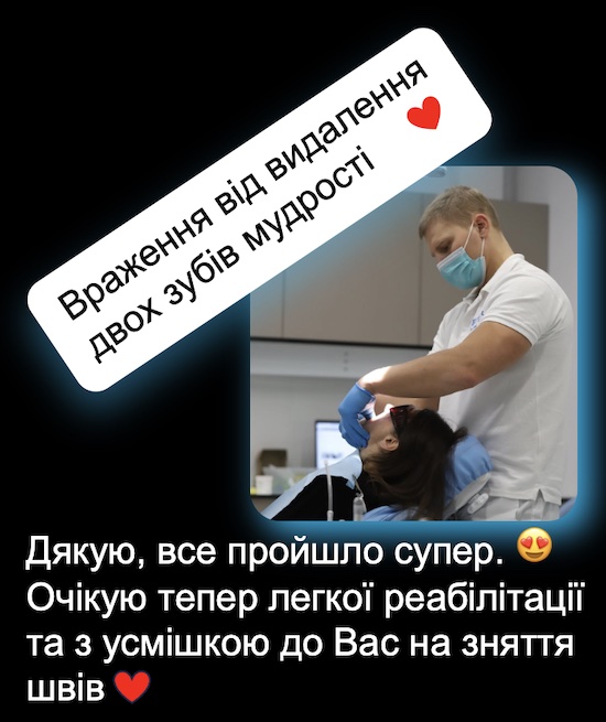 відгук видалення зубів мудрості