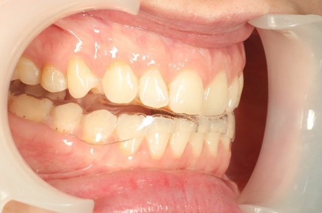 Фото отчет лечения у гнатолога в DentalKnysh, 2026-05-03, фото 1