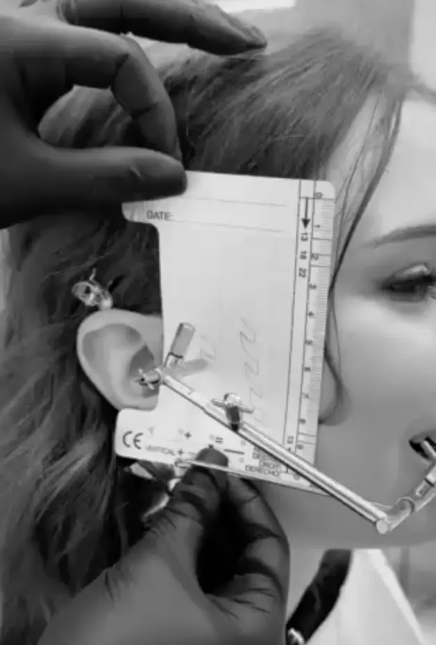 Процесс функциональной диагностики у гнатолога в DentalKnysh, видео, 2026-05-03