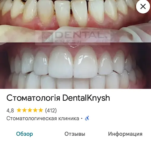 DentalKnysh rating on Google Maps