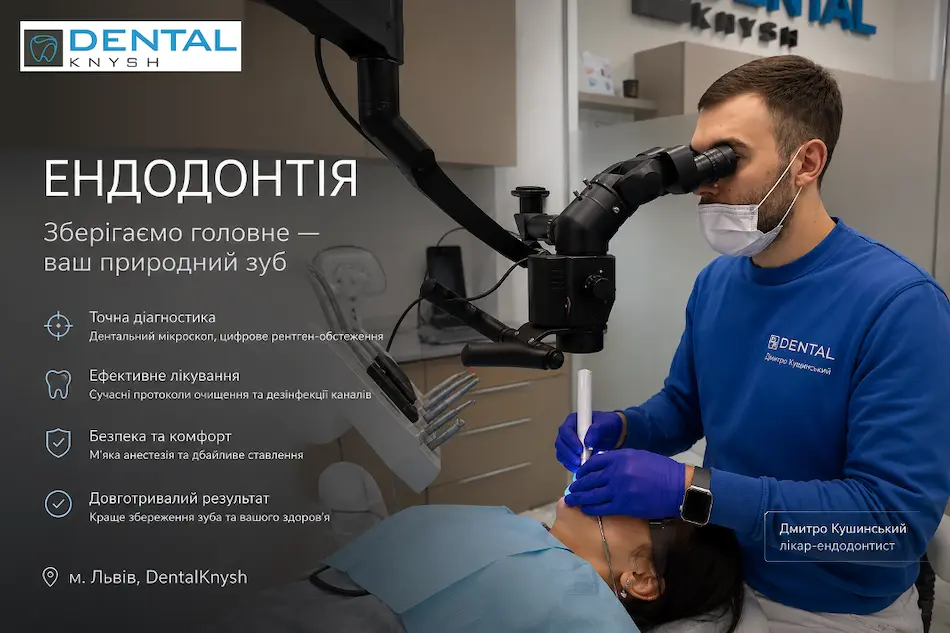 Лікування каналів Львів DentalKnysh